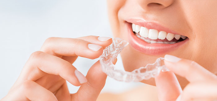 Invisalign - The Ultimate Alternative to Braces — Valley Creek